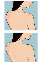 Skin Sensual Buttoks Buttne Vücut Maskesi