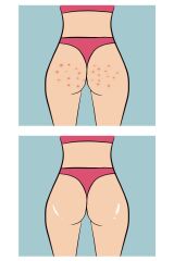 Skin Sensual Buttoks Buttne Vücut Maskesi